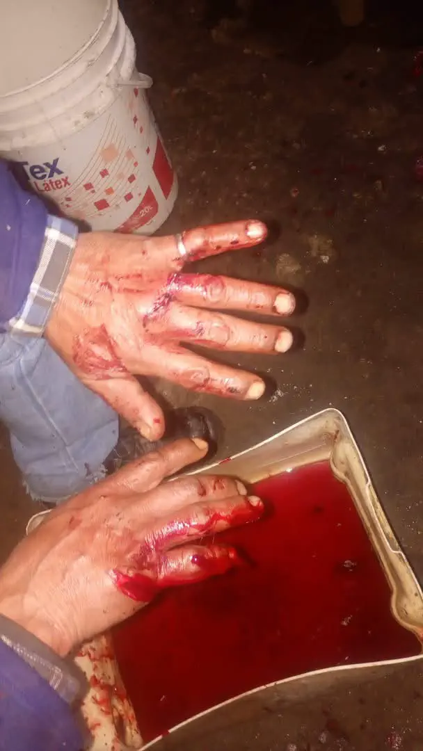 Brutal ataque con machete en Las Chacritas: un hombre sufrió graves heridas con un machete tras una discusión