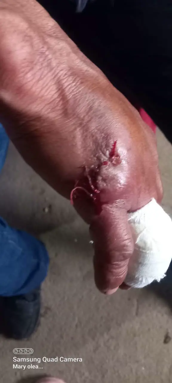 Brutal ataque con machete en Las Chacritas: un hombre sufrió graves heridas con un machete tras una discusión